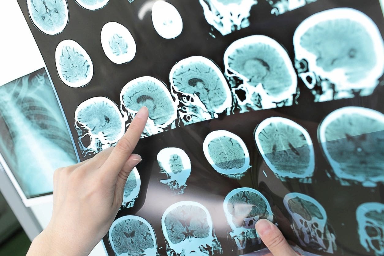A person is touching the image of an mri scan.